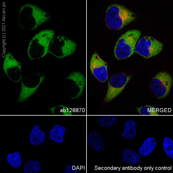 Immunocytochemistry/ Immunofluorescence - Anti-Fatty Acid Synthase antibody [EPR7466] - BSA and Azide free (AB221934)