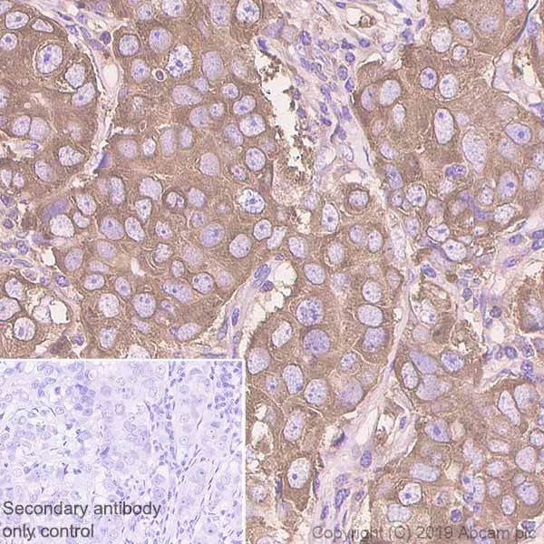 Immunohistochemistry (Formalin/PFA-fixed paraffin-embedded sections) - Anti-Fatty Acid Synthase antibody [EPR7466] - BSA and Azide free (AB221934)