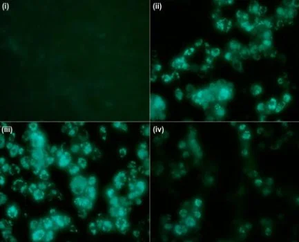 Fluorescence Microscopy - Fatty Acid Uptake Assay Kit (AB287857)