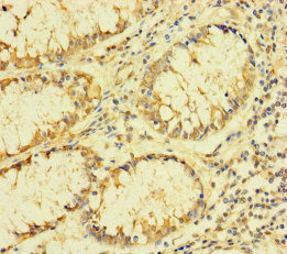 Anti-FAU / 40S ribosomal protein S30 antibody (ab234835) | Abcam