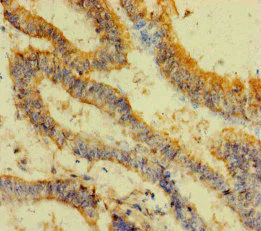 Immunohistochemistry (Formalin/PFA-fixed paraffin-embedded sections) - Anti-FAU / 40S ribosomal protein S30 antibody (AB234835)