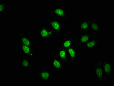 Immunocytochemistry/ Immunofluorescence - Anti-FAU / 40S ribosomal protein S30 antibody (AB239073)