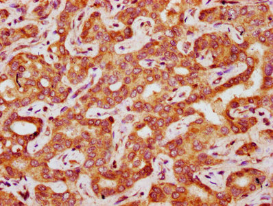 Immunohistochemistry (Formalin/PFA-fixed paraffin-embedded sections) - Anti-FAU / 40S ribosomal protein S30 antibody (AB239073), expandable thumbnail