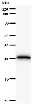 Western blot - Anti-FBH1 antibody [2353C1a] (AB58881)