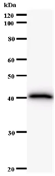 Western blot - Anti-FBH1 antibody [2353C1a] (AB58881)