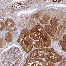 Immunohistochemistry (Formalin/PFA-fixed paraffin-embedded sections) - Anti-FBN3 antibody (AB151065)