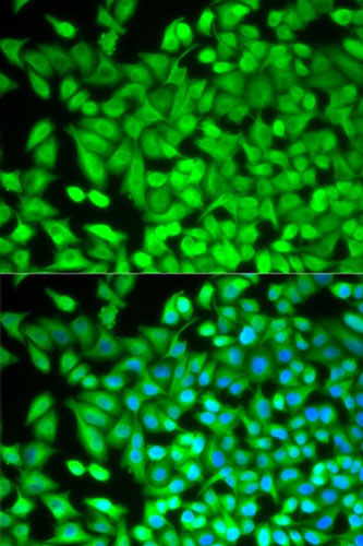Immunocytochemistry/ Immunofluorescence - Anti-FBP1 antibody (AB196556)