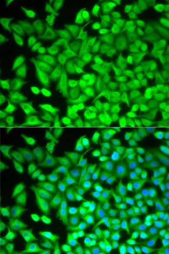 Immunocytochemistry/ Immunofluorescence - Anti-FBP1 antibody (AB196556)