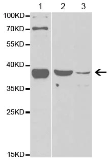 Western blot - Anti-FBP1 antibody (AB196556)