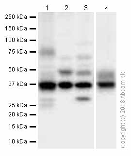 Western blot - Anti-FBP1 antibody [EPR4620] (AB109732), expandable thumbnail