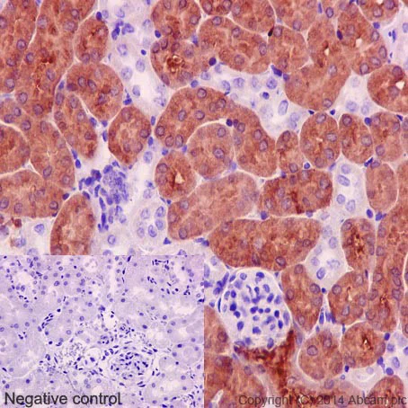 Immunohistochemistry (Formalin/PFA-fixed paraffin-embedded sections) - Anti-FBP1 + FBP2 antibody [EPR4619] (AB109020)