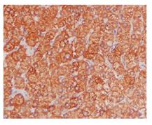 Immunohistochemistry (Formalin/PFA-fixed paraffin-embedded sections) - Anti-FBP1 + FBP2 antibody [EPR4619] (AB109020)