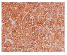 Immunohistochemistry (Formalin/PFA-fixed paraffin-embedded sections) - Anti-FBP1 + FBP2 antibody [EPR4619] (AB109020)