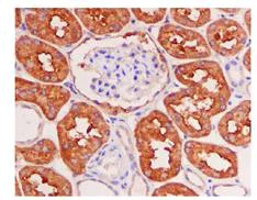 Immunohistochemistry (Formalin/PFA-fixed paraffin-embedded sections) - Anti-FBP1 + FBP2 antibody [EPR4619] (AB109020)