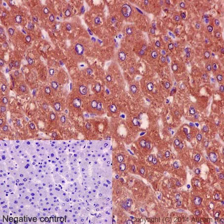 Immunohistochemistry (Formalin/PFA-fixed paraffin-embedded sections) - Anti-FBP1 + FBP2 antibody [EPR4619] (AB109020)