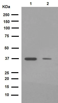 Western blot - Anti-FBP1 + FBP2 antibody [EPR4619] (AB109020)