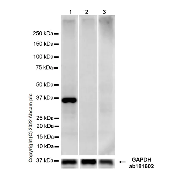 Western blot - Anti-FBP1 + FBP2 antibody [EPR7435] (AB131333)