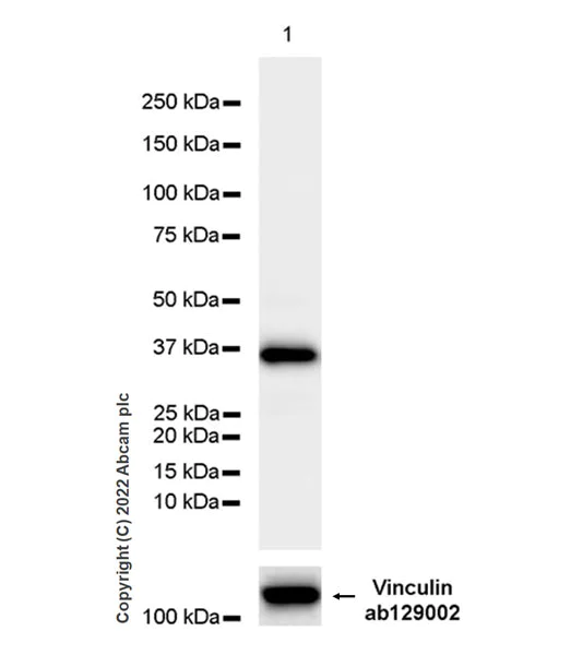 Western blot - Anti-FBP1 + FBP2 antibody [EPR7435] (AB131333)