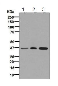 Western blot - Anti-FBP1 + FBP2 antibody [EPR7435] (AB131333)