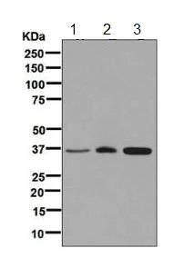 Western blot - Anti-FBP1 + FBP2 antibody [EPR7435] (AB131333)