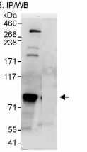 Immunoprecipitation - Anti-FBP17 antibody (AB100918), expandable thumbnail