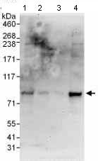 Western blot - Anti-FBP17 antibody (AB100918), expandable thumbnail