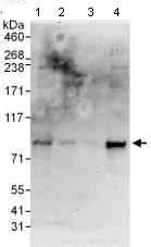 Western blot - Anti-FBP17 antibody (AB100918)