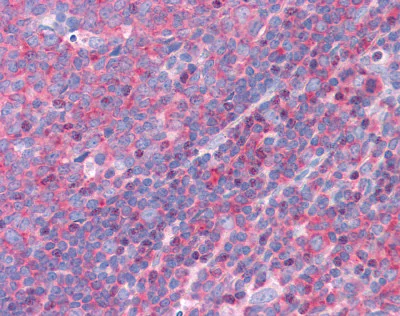 Immunohistochemistry (Formalin/PFA-fixed paraffin-embedded sections) - Anti-FBP17 antibody (AB113961)