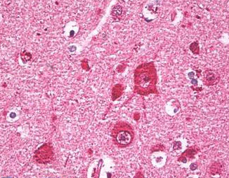 Immunohistochemistry (Formalin/PFA-fixed paraffin-embedded sections) - Anti-FBP17 antibody (AB150577)