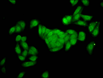 Immunocytochemistry/ Immunofluorescence - Anti-FBP2 antibody (AB236660)