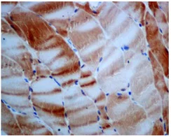 Immunohistochemistry (Formalin/PFA-fixed paraffin-embedded sections) - Anti-FBP2 antibody [EPR7436] (AB131253)