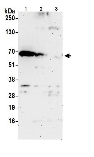 Western blot - Anti-FBSH antibody (AB264403)