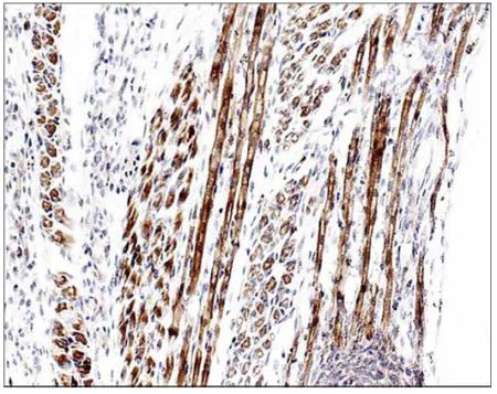 Immunohistochemistry (Formalin/PFA-fixed paraffin-embedded sections) - Anti-Fbx32 antibody (AB157596)