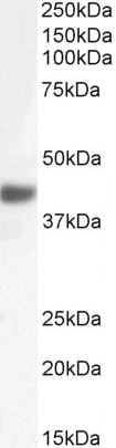 Western blot - Anti-Fbx32 antibody (AB92281)