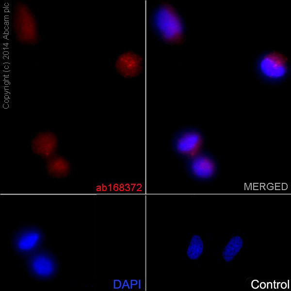 Immunocytochemistry/ Immunofluorescence - Anti-Fbx32 antibody [EPR9148(2)] (AB168372), expandable thumbnail