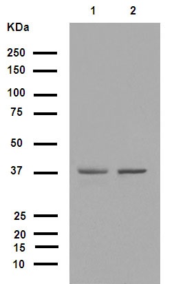 Western blot - Anti-Fbx32 antibody [EPR9148(2)] (AB168372), expandable thumbnail