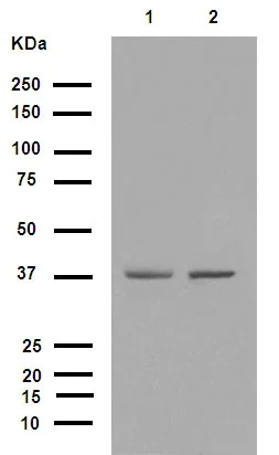 その他 a.396 Anti-Fbx32 antibody [EPR9148(2)]. Rabbit Monoclonal (ab168372) | Abcam
