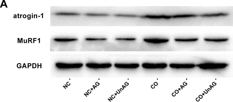 Western blot - Anti-Fbx32 antibody [EPR9148(2)] (AB168372)