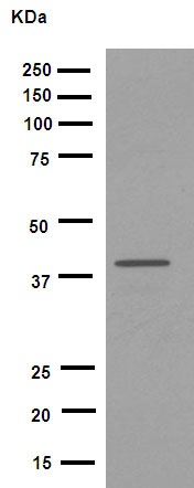 Western blot - Anti-Fbx32 antibody [EPR9148(2)] (AB168372), expandable thumbnail