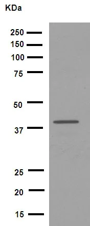 Western blot - Anti-Fbx32 antibody [EPR9148(2)] (AB168372)