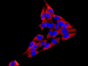 Immunocytochemistry/ Immunofluorescence - Anti-Fbx32 antibody [EPR9148(2)] - BSA and Azide free (AB240956)