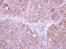Immunohistochemistry (Formalin/PFA-fixed paraffin-embedded sections) - Anti-FbxL12 antibody (AB96831), expandable thumbnail