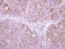 Immunohistochemistry (Formalin/PFA-fixed paraffin-embedded sections) - Anti-FbxL12 antibody (AB96831)