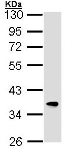 Western blot - Anti-FbxL12 antibody (AB96831), expandable thumbnail