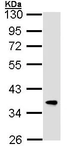 Western blot - Anti-FbxL12 antibody (AB96831)