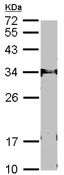 Western blot - Anti-FbxL12 antibody (AB96831)