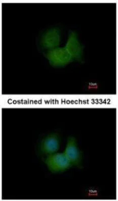 Immunocytochemistry/ Immunofluorescence - Anti-FBXL16 antibody (AB272898)