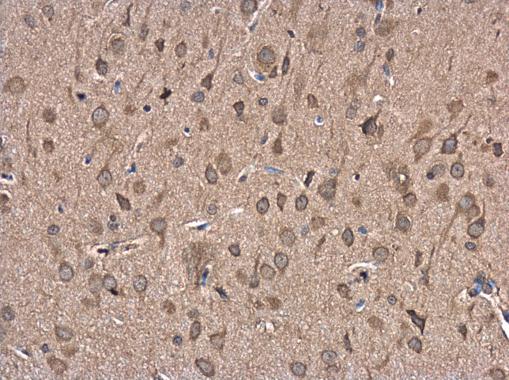 Immunohistochemistry (Formalin/PFA-fixed paraffin-embedded sections) - Anti-FBXL16 antibody (AB272898)