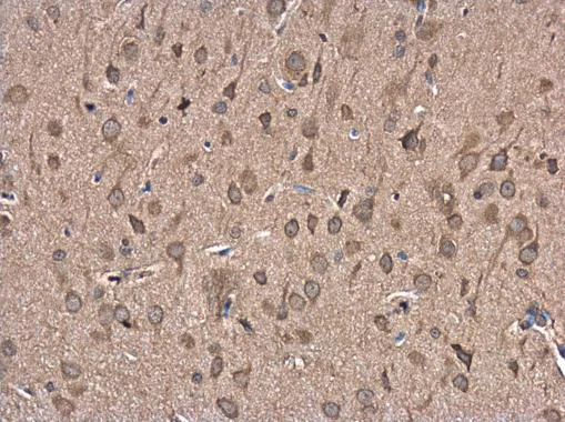 Immunohistochemistry (Formalin/PFA-fixed paraffin-embedded sections) - Anti-FBXL16 antibody (AB272898)
