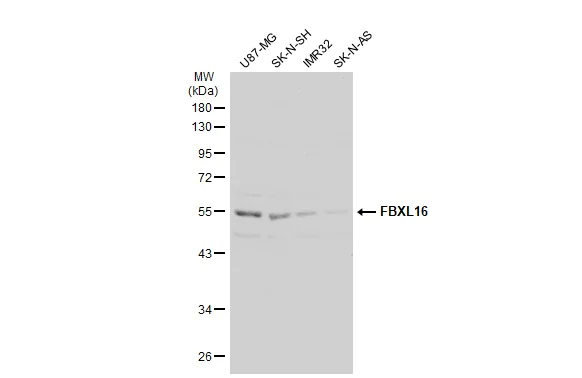 Western blot - Anti-FBXL16 antibody (AB272898)